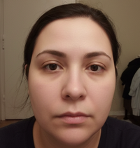 Finally satisfied with my skin